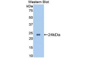 Western Blotting (WB) image for anti-Orosomucoid 1 (ORM1) (AA 19-207) antibody (ABIN3207792) (ORM1 anticorps  (AA 19-207))