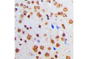 Immunohistochemical analysis of ADAR2 staining in human brain formalin fixed paraffin embedded tissue section.