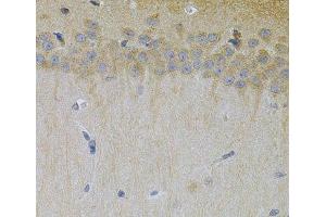 Immunohistochemistry of paraffin-embedded Mouse brain using ERBB3 Polyclonal Antibody at dilution of 1:100 (40x lens). (ERBB3 anticorps)