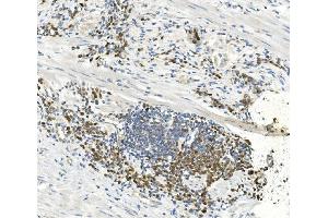 IHC analysis of EEF2 using anti-EEF2 antibody (ABIN7603141). (EEF2 anticorps  (N-Term))