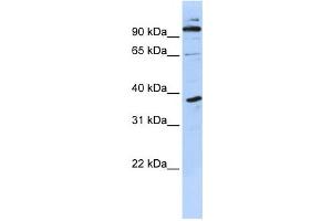 Western Blotting (WB) image for anti-PHD Finger Protein 11 (PHF11) antibody (ABIN2458372) (PHF11 anticorps)