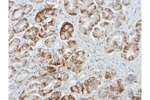 IHC-P Image Immunohistochemical analysis of paraffin-embedded human stomach, using UNC13D, antibody at 1:100 dilution. (UNC13D anticorps  (C-Term))