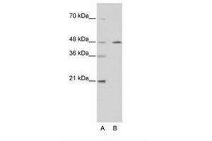 Image no. 2 for anti-Nuclear Receptor Subfamily 2, Group F, Member 2 (NR2F2) (AA 141-190) antibody (ABIN6736209) (NR2F2 anticorps  (AA 141-190))