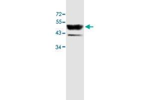 Western blot analysis of human fetal skeletal muscle lysate with ACTL6B polyclonal antibody  at 1 : 500 dilution. (Actin-Like 6B anticorps  (AA 178-452))