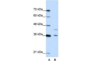 WB Suggested Anti-NKD2 Antibody Titration:  0.