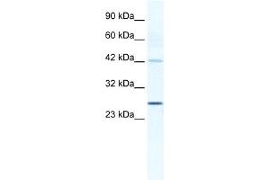 WB Suggested Anti-GJB4 Antibody Titration:  1. (GJB4 anticorps  (Middle Region))