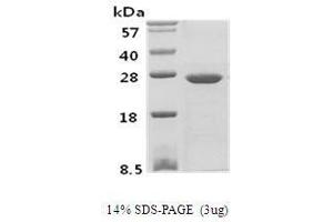 Figure annotation denotes ug of protein loaded and % gel used.