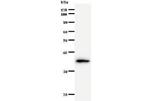 Western Blotting (WB) image for anti-General Transcription Factor IIA, 1, 19/37kDa (GTF2A1) antibody (ABIN931060) (GTF2A1 anticorps)