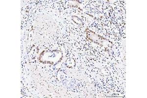 IHC analysis of DDX1 using anti-DDX1 antibody (ABIN7602052).