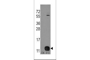 Western blot analysis of PHPT1 (arrow) using rabbit polyclonal PHPT1 Antibody (Human N-term). (PHPT1 anticorps  (N-Term))