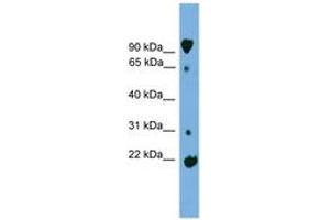 Image no. 1 for anti-Kelch-Like 2, Mayven (KLHL2) (AA 179-228) antibody (ABIN6744966) (KLHL2 anticorps  (AA 179-228))