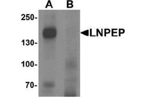 Western blot analysis of LNPEP in human lung tissue lysate with LNPEP Antibody  at 1 ug/mL in (A) the absence and (B) the presence of blocking peptide. (LNPEP anticorps  (C-Term))