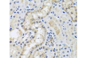 Immunohistochemistry of paraffin-embedded Mouse kidney using CETN3 Polyclonal Antibody at dilution of 1:100 (40x lens).