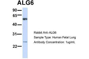 Host:  Rabbit  Target Name:  ALG6  Sample Type:  Human Fetal Lung  Antibody Dilution:  1. (ALG6 anticorps  (N-Term))