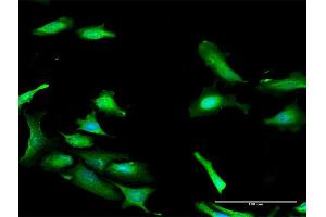 Immunofluorescence of purified MaxPab antibody to PDCD2 on HeLa cell. (PDCD2 anticorps  (AA 1-344))