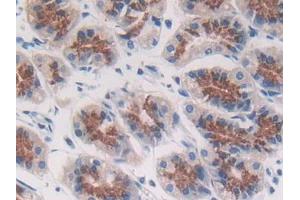 IHC-P analysis of Human Stomach Tissue, with DAB staining. (ACP5 anticorps  (AA 79-318))