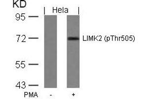 Western blot analysis of extracts from Hela cells untreated or treated with PMA using LIMK2(Phospho-Thr505) Antibody. (LIMK2 anticorps  (pThr505))