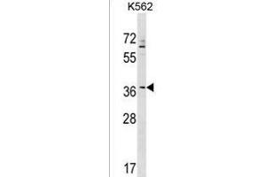ZNF385A Antibody (N-term) (ABIN1539472 and ABIN2849352) western blot analysis in K562 cell line lysates (35 μg/lane).