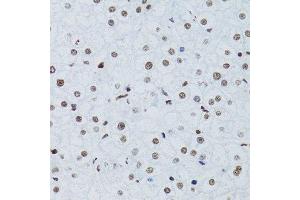 Immunohistochemistry of paraffin-embedded human liver using NFKB2 Antibody.