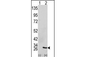 Western blot analysis of GRB2 (arrow) using GRB2 Antibody (Center) (ABIN390238 and ABIN2840708).