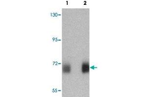 Western blot analysis of human skeletal muscle tissue lysate with PRC1 polyclonal antibody  at (1) 0.