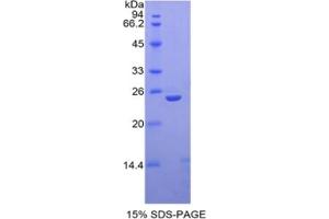 SDS-PAGE of Protein Standard from the Kit (Highly purified E. (Thrombospondin 1 Kit CLIA)