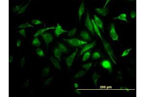 Immunofluorescence of monoclonal antibody to RAB3B on HeLa cell.