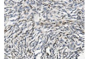 IHC analysis of NHEJ1 using anti-NHEJ1 antibody (ABIN7599198). (NHEJ1 anticorps  (AA 1-273))