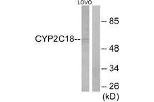 Western blot analysis of extracts from LOVO cells, using Cytochrome P450 2C8/9/18/19 Antibody. (Cytochrome P450 2C8/9/18/19 (AA 111-160) anticorps)