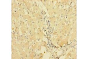 Immunohistochemistry of paraffin-embedded human liver tissue using ABIN7167514 at dilution of 1:100 (PTPRR anticorps  (AA 1-412))
