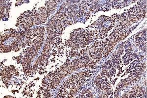 IHC analysis of FEN1 using anti-FEN1 antibody (ABIN7601618). (FEN1 anticorps  (AA 4-300))