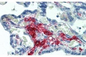 Detection of FE in Human Placenta Tissue using Polyclonal Antibody to Ferritin (FE) (Ferritin anticorps)