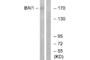 Immunohistochemistry analysis of paraffin-embedded human brain tissue using BAI1 antibody. (BAI1 anticorps  (Internal Region))