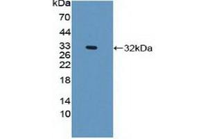 Detection of Recombinant PLEC, Human using Polyclonal Antibody to Plectin (PLEC) (PLEC anticorps  (AA 175-400))