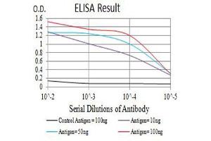 Black line: Control Antigen (100 ng),Purple line: Antigen (10 ng), Blue line: Antigen (50 ng), Red line:Antigen (100 ng)