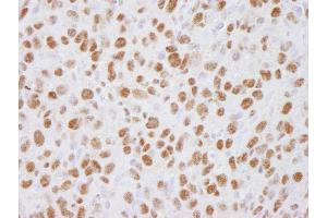 Immunohistochemistry (IHC) image for anti-Ubiquitin Specific Peptidase 7 (Herpes Virus-Associated) (USP7) (AA 1-50) antibody (ABIN7449033)