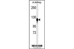Western blot analysis of anti-EGFR Antibody (S1070) in kidney heart tissue lysates (35ug/lane) (EGF anticorps  (AA 1048-1077))