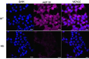 Immunocytochemical staining of HeLa cells using AKR1B1 antibody (ABIN7797570), 1:1,000), Top panel: wild-type (WT), Bottom panal: AKR1B1 shRNA knockdown (KD).