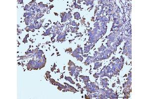IHC analysis of TARS2 using anti-TARS2 antibody (ABIN7602308).