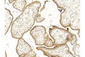 anti-CD59 (CD59) (AA 74-110) antibody