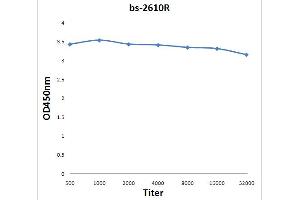 0. (IL17 Receptor B anticorps  (AA 351-450))