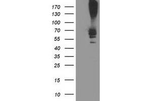 Western Blotting (WB) image for anti-Ribophorin 1 (RPN1) antibody (ABIN1500754)