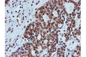 Image no. 12 for anti-Fragile X Mental Retardation 1 (FMR1) antibody (ABIN1498287)