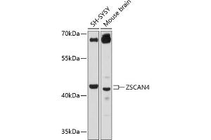 Western blot analysis of extracts of various cell lines, using ZSC antibody (ABIN6133026, ABIN6150544, ABIN6150546 and ABIN6215572) at 1:3000 dilution. (ZSCAN4 anticorps  (AA 1-310))