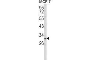 Western Blotting (WB) image for anti-NK3 Homeobox 1 (NKX3-1) antibody (ABIN3003998) (NKX3-1 anticorps)