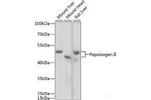 Western blot analysis of extracts of various cell lines using Pepsinogen II Polyclonal Antibody at dilution of 1:1000. (PGC anticorps)