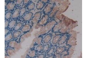 Detection of CXCL16 in Mouse Intestine Tissue using Polyclonal Antibody to Chemokine C-X-C-Motif Ligand 16 (CXCL16)