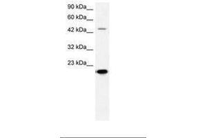 Image no. 2 for anti-Matrix Metallopeptidase 19 (MMP19) (AA 349-398) antibody (ABIN202685) (MMP19 anticorps  (AA 349-398))