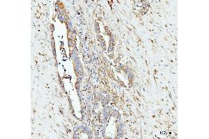 IHC analysis of Grp75 using anti-Grp75 antibody (ABIN7602782). (HSPA9 anticorps  (C-Term))