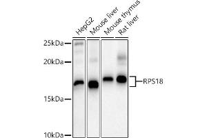 Western blot analysis of extracts of various cell lines, using RPS18 antibody (ABIN6128660, ABIN6147205, ABIN6147206 and ABIN6215379) at 1:1000 dilution. (RPS18 anticorps  (AA 1-152))